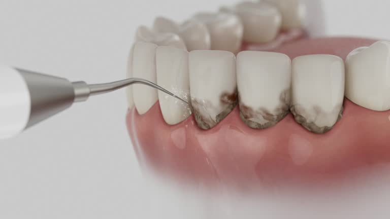 Reliable Dental Implants contractor in Chickamauga, GA by Smile Center Dentistry
